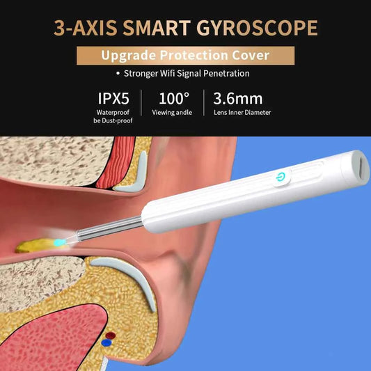 Smart Visual Ear Cleaner with 1296P Camera, USB C Charging, WIFI Connection, 6 LED Lights Earpick for Easy Ear Wax Removal